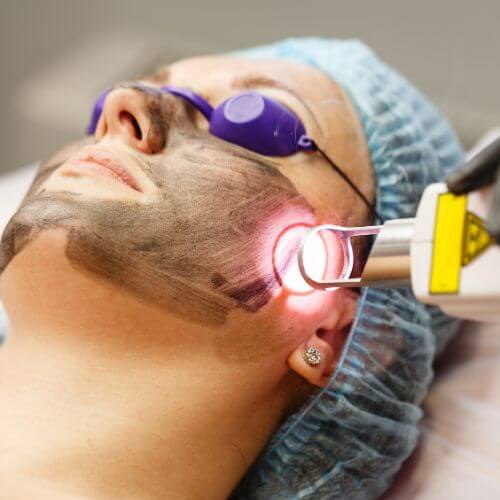 tratamientos de rejuvenecimiento facial