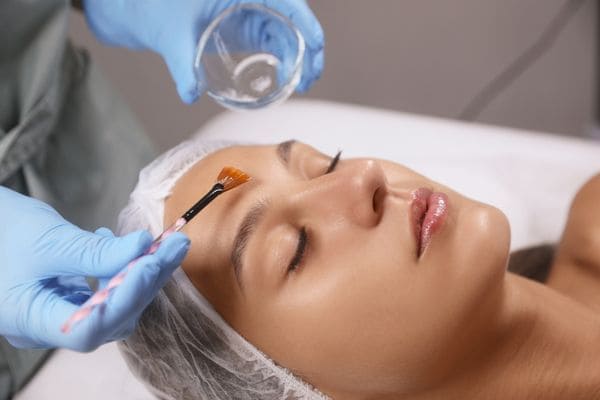 Peeling facial en Palma de Mallorca